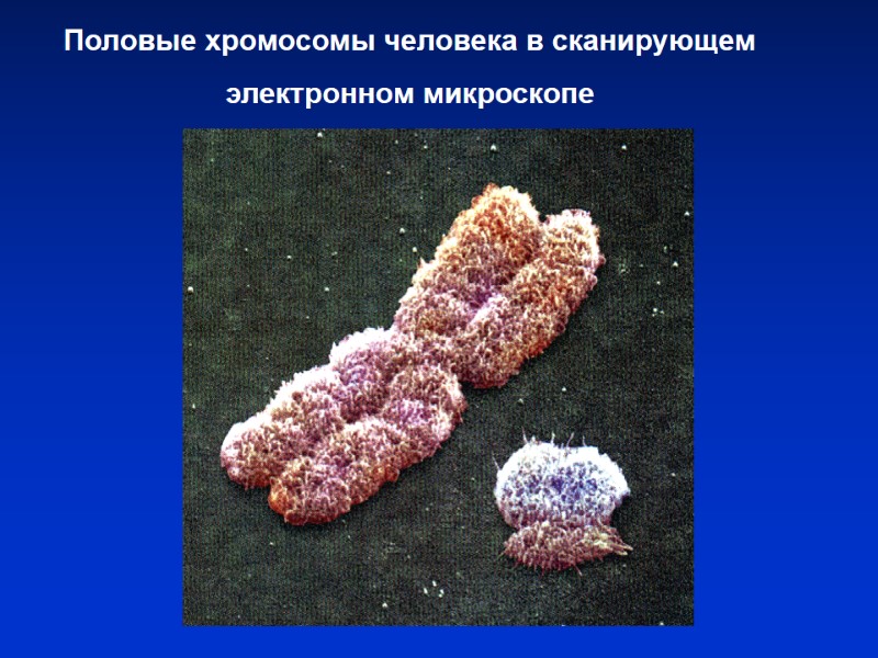 Половые хромосомы человека в сканирующем электронном микроскопе Половые хромосомы человека в сканирующем электронном микроскопе